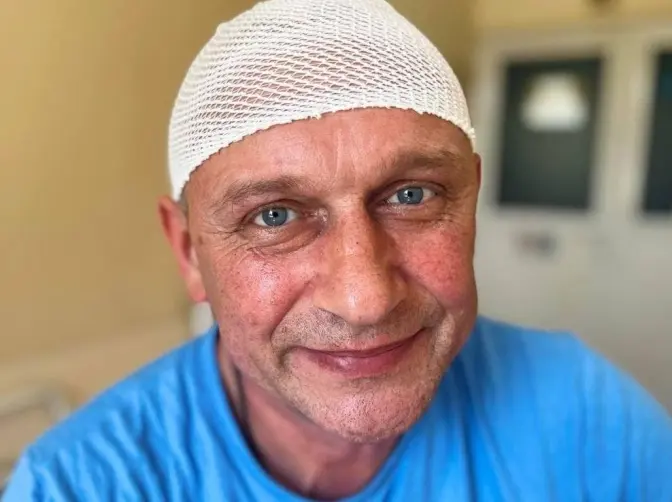 Львівські нейрохірурги видалили гігантську пухлину мозку чоловіку, який збирався їхати на фронт