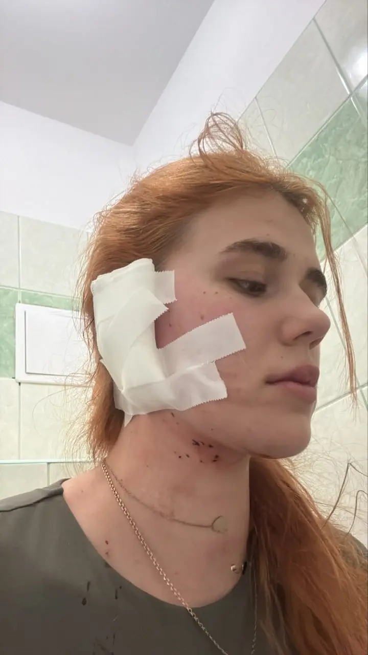 Настю та її хлопця Максима госпіталізували з тяжкими травмами 