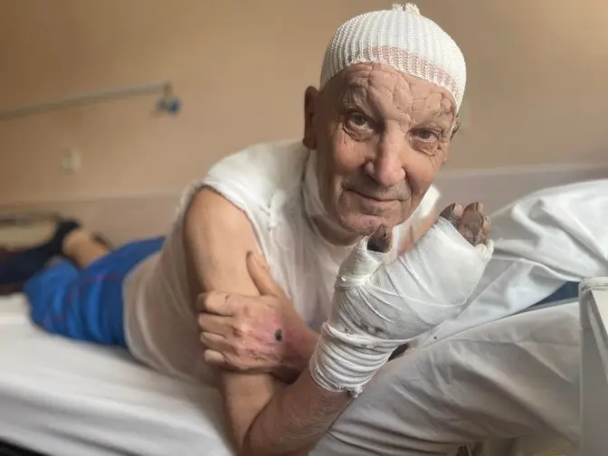 Одяг згорів на ньому. У Львові від опіків рятують 75-річного чоловіка з Попасної