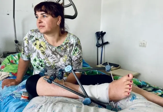Львівські медики врятували жінку з Авдіївки, яка отримала важке поранення через влучання ворожих ракет