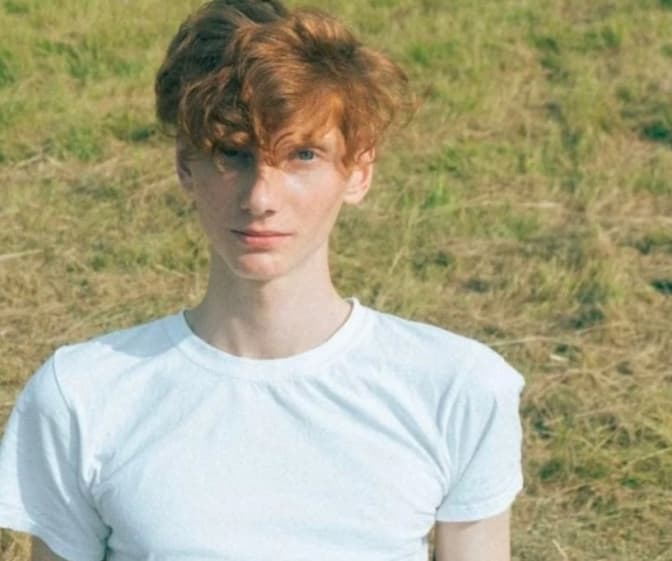 Втратив око після удару FPV-дрона: для бійця 80-ї Галицької бригади збирають кошти на лікування