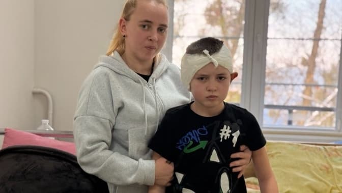 10-річному хлопчику з Львівщини повернули слух після тяжкого бактеріального менінгіту