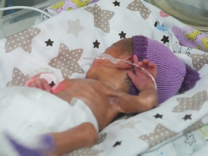 Нас називають «поспішайки». Як у Львові доглядають передчасно народжених дітей