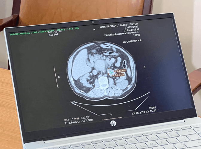 Львівські хірурги під час майже 9-годинної операції врятували чоловіка з рідкісною патологією