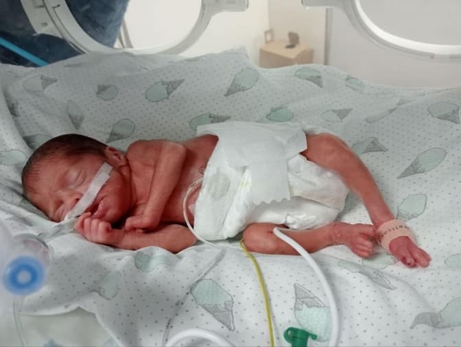 Фото: Львівський обласний перинатальний центр