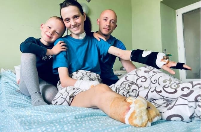 Втратила руку, ногу та дитину під серцем. Львівські лікарі надали допомогу важкопораненій жінці з Донеччини