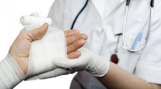 Закурив і заснув. Із якими опіками найчастіше львів'яни потрапляють в опіковий центр