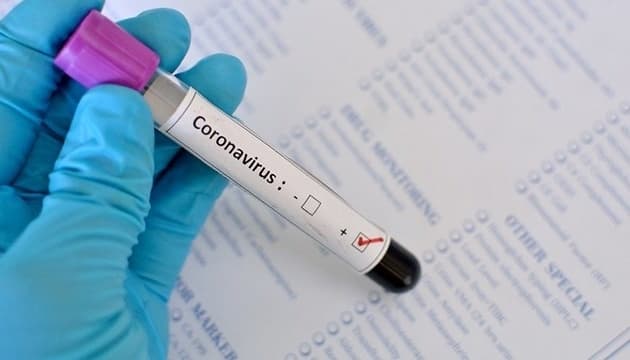 Чому в Україні різко зростає кількість нових хворих на Covid-19. Пояснення епідеміолога