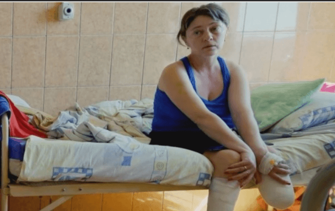 У Львові лікують маму з дочкою, яким після обстрілів у Краматорську ампутували ноги