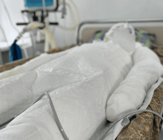 На Львівщині чоловік отримав 80% опіків тіла через вибух каністри з бензином