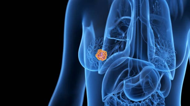 Який вид раку є найпоширенішим і на що звернути увагу