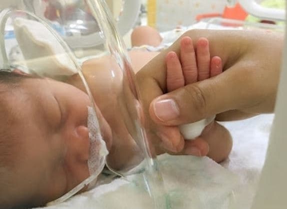 Медики розповіли про стан 4-місячного хлопчика, якого доправили гелікоптером до Львова