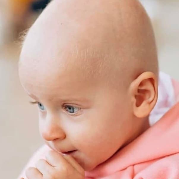 У Львові терміново шукають донорів тромбоцитів для дворічної Єви Вакуленко з лейкемією