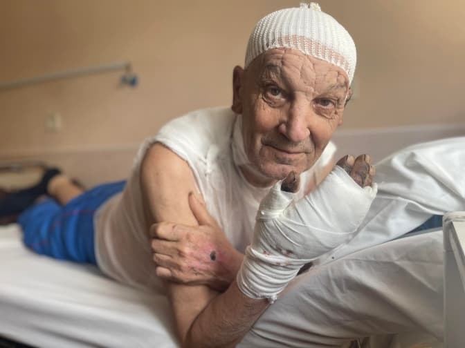 Одяг згорів на ньому. У Львові від опіків рятують 75-річного чоловіка з Попасної