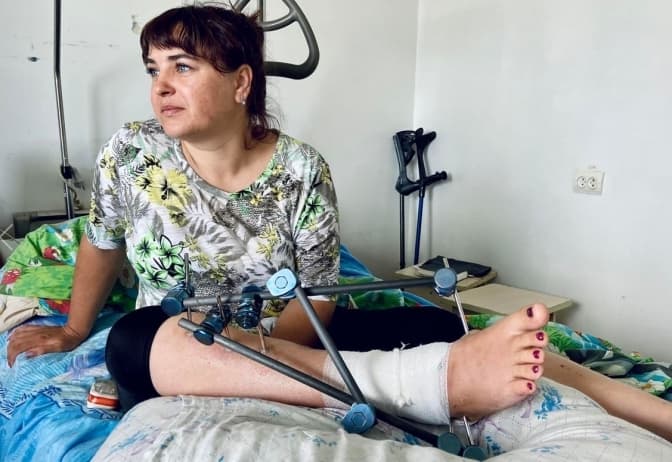 Львівські медики врятували жінку з Авдіївки, яка отримала важке поранення через влучання ворожих ракет