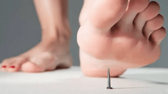 фото умовне