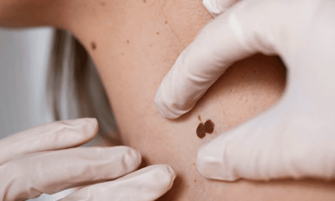 Фото умовне