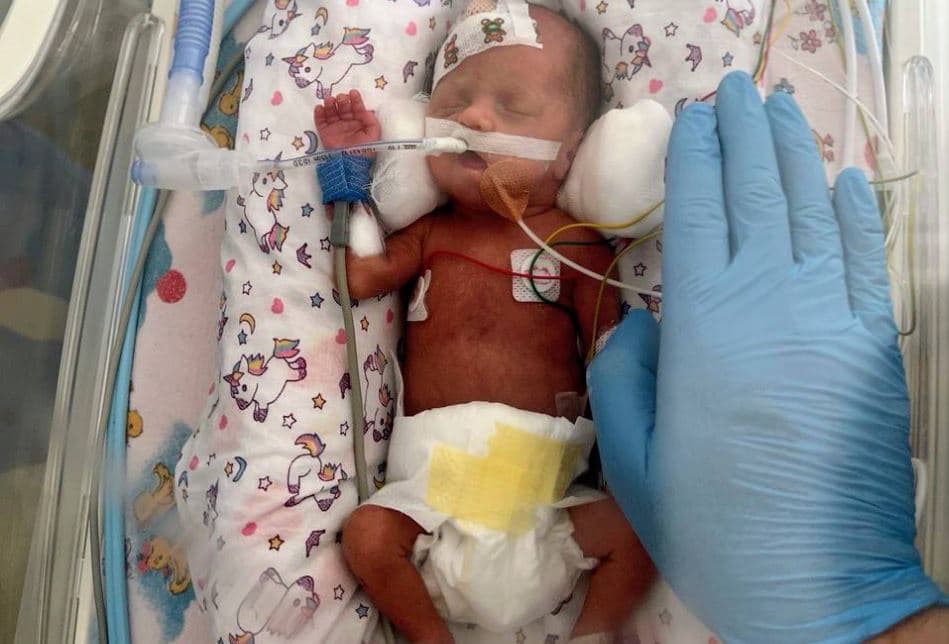 Фото: Перше ТМО