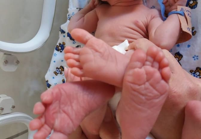 У перинатальному центрі у Львові народилися перші трійнята