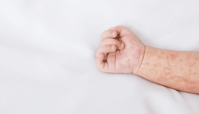 фото умовне