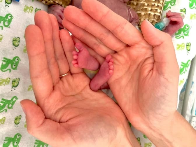 Вагою шістсот грам. Львівські лікарі виходили новонароджену дівчинку