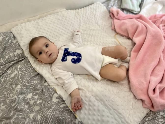 Львівські лікарі прооперували 7-місячну дівчинку, в якої могла перестати функціонувати нирка