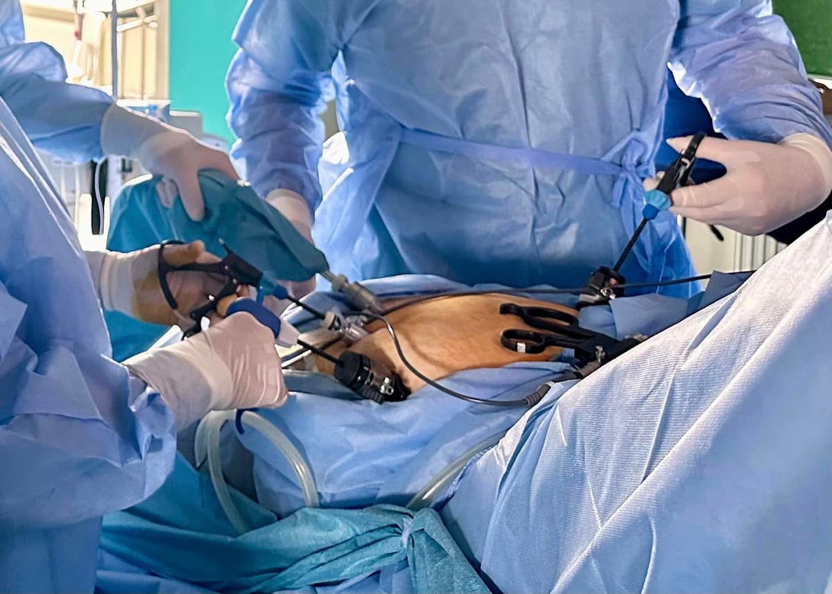 В жінки була пухлина на чверть метра з 9 літрами води. У Львові її прооперували