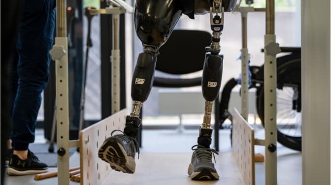 У Львівському медуніверситеті відкриють мікроклініку для реабілітації та протезування військових