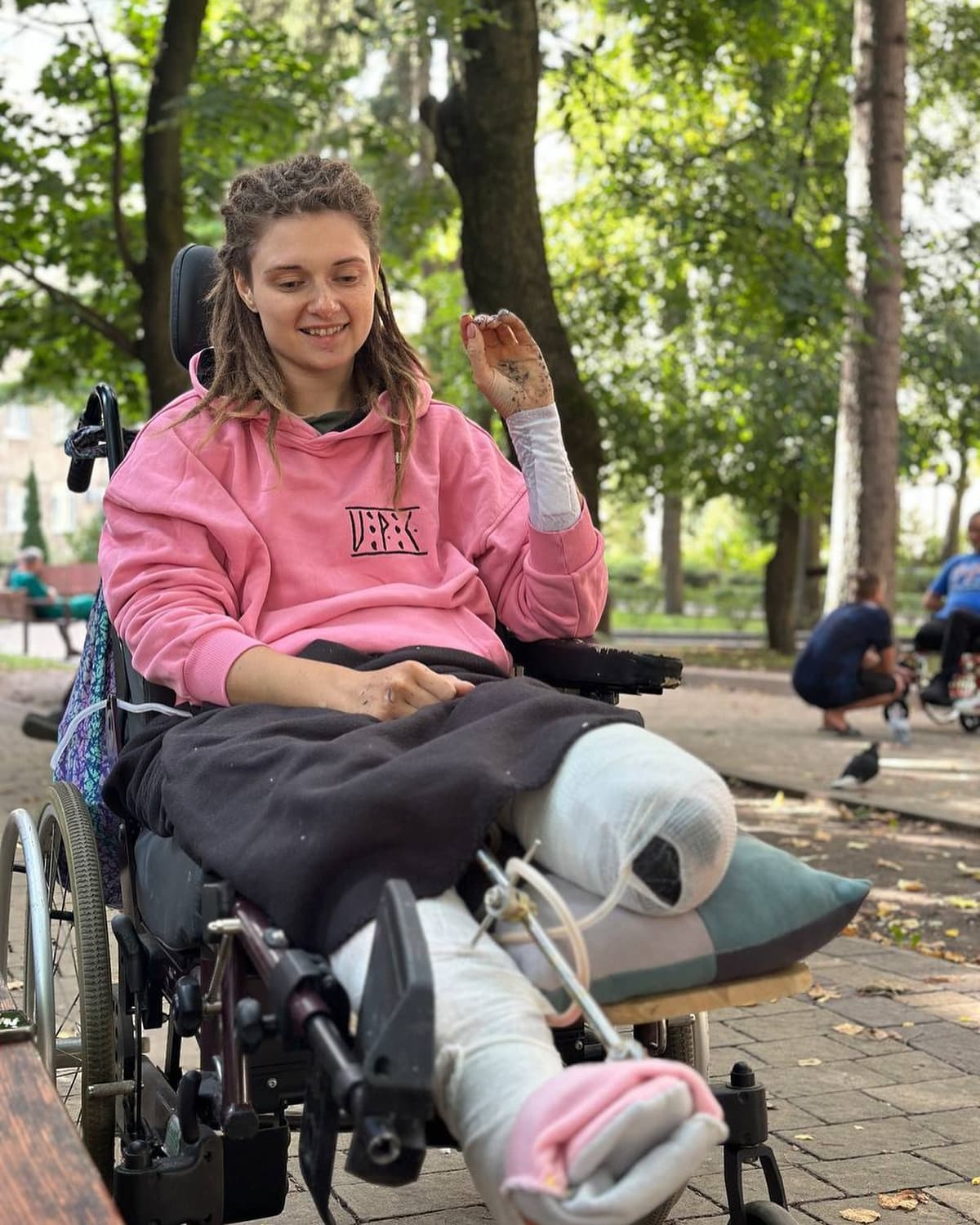 «Я втратила ногу, але є й хороша новина»