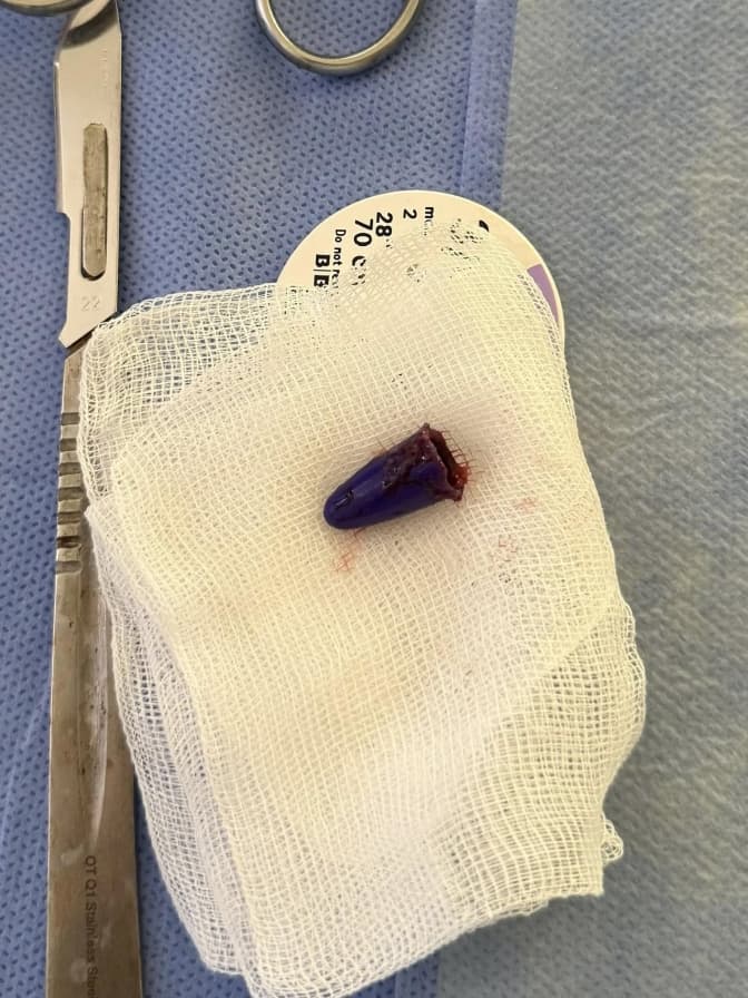 Умовне фото