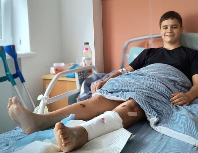 На Львівщині вдвічі побільшало підлітків з травмами після ДТП на мотоциклах