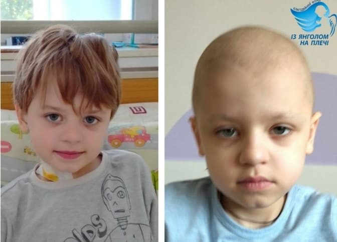 Чекають пів року. У Львові терміново збирають кошти на лікування 5-річному хлопчику