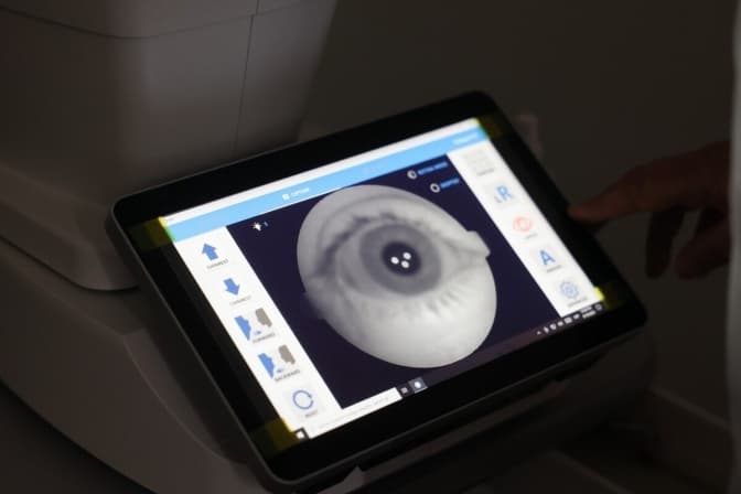 Де у Львові можна безкоштовно пройти цифровий скринінг зору з допомогою ШІ