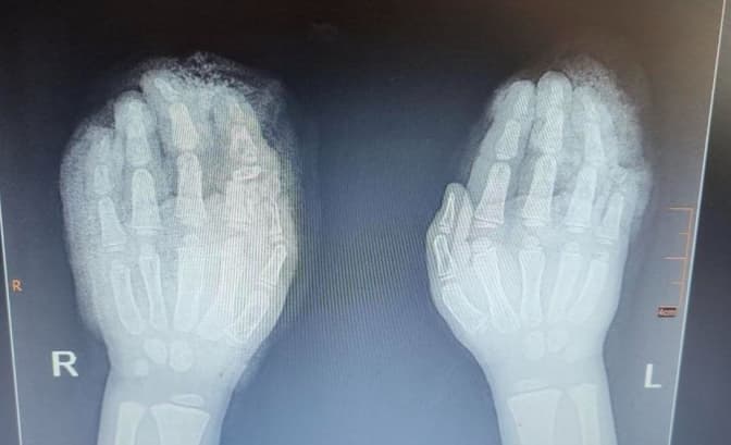 фото: охматдит