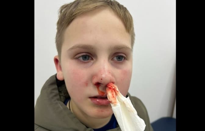 фото: Анна Пелешко