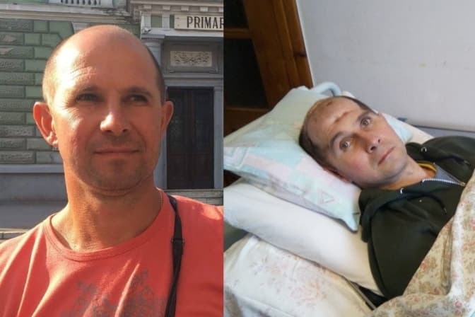 Львів’ян просять допомогти 51-річному чоловіку, що травмувався на будівництві