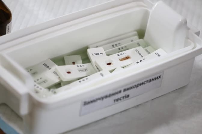 Учені почали тестувати дві вакцини від коронавірусу