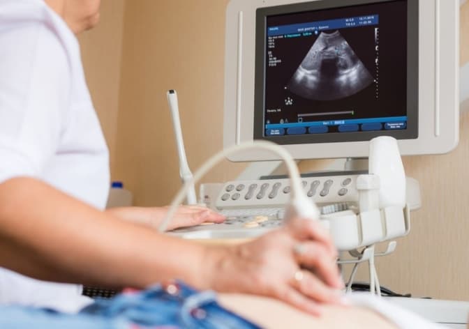 Фото умовне