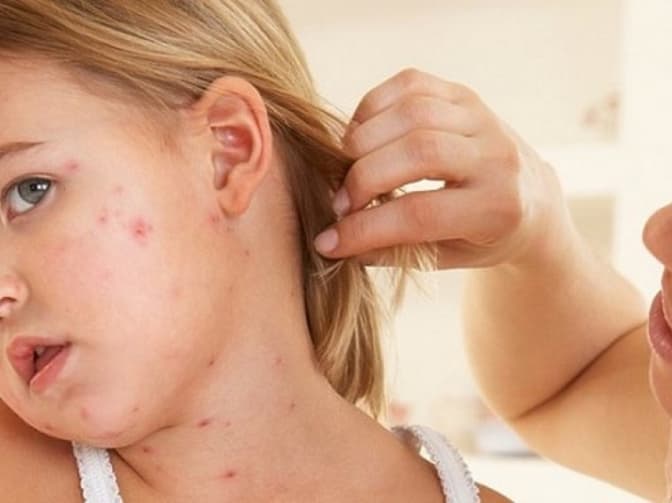 Умовне фото