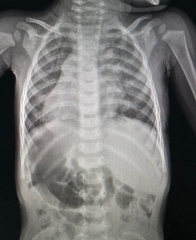 Органи хлопчика розміщені дзеркально