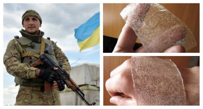 Українські вчені зробили винахід, корисний для бійців АТО