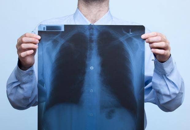 У Львові ремонтуватимуть протитуберкульозний диспансер