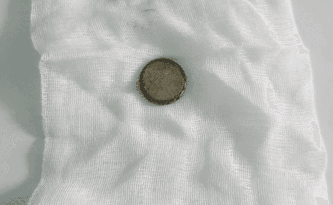 На Львівщині трирічна дівчинка проковтнула батарейку від ваги