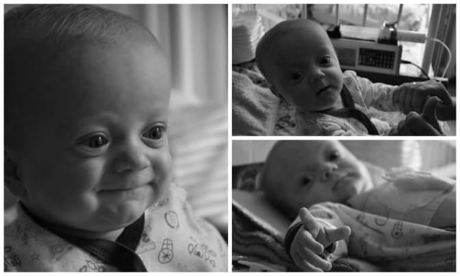 9-місячний хлопчик зі Львова потребує рідкісної операції