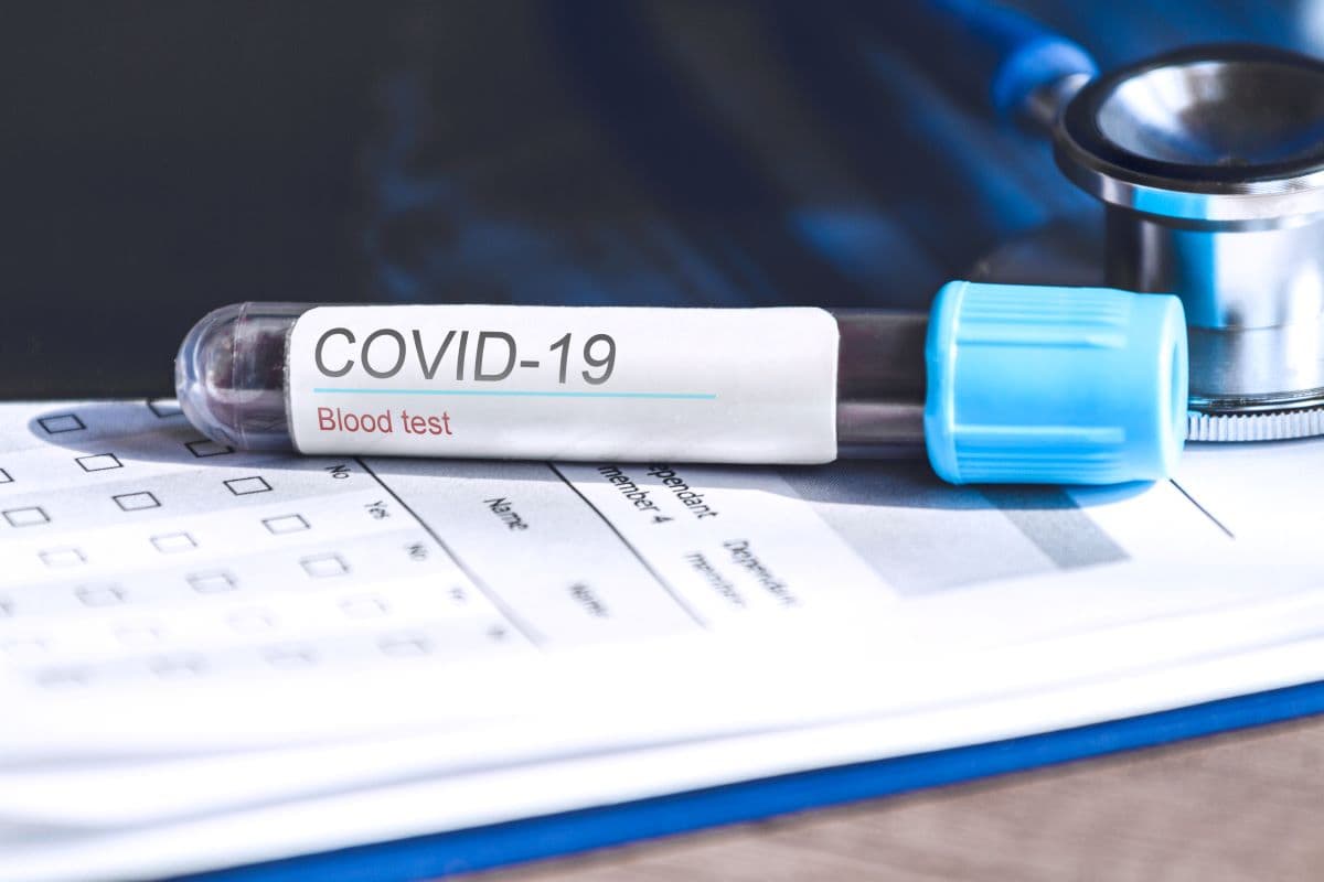 За минулу добу в Україні на Covid-19 захворіли ще 848 людей