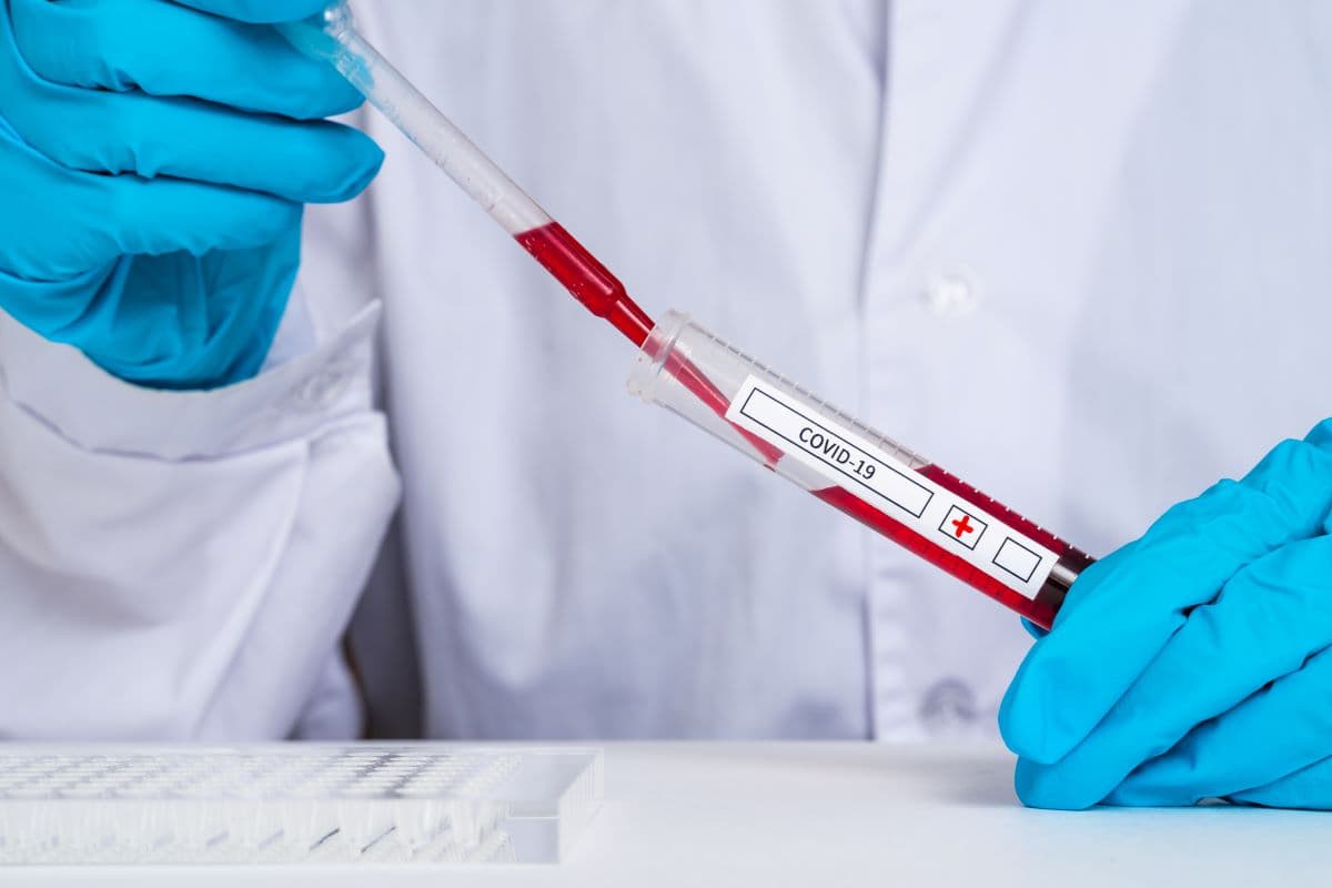 В Україні за добу виявили 829 нових хворих на Covid-19