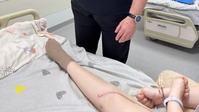 Львівські лікарі зберегли ногу 16-річній дівчині з агресивною злоякісною пухлиною