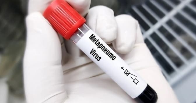 Чи справді метапневмовірус такий небезпечний і яка ситуація на Львівщині
