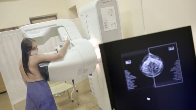 Безкоштовна мамографія у Львові: графік обстежень у грудні