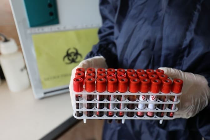 В Україні підтвердили ще 5,8 тисяч інфікувань коронавірусом. Яка ситуація на Львівщині